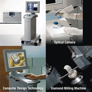CEREC technology, from imaging to production